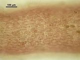 6 – Cellule corticali in visione superficiale